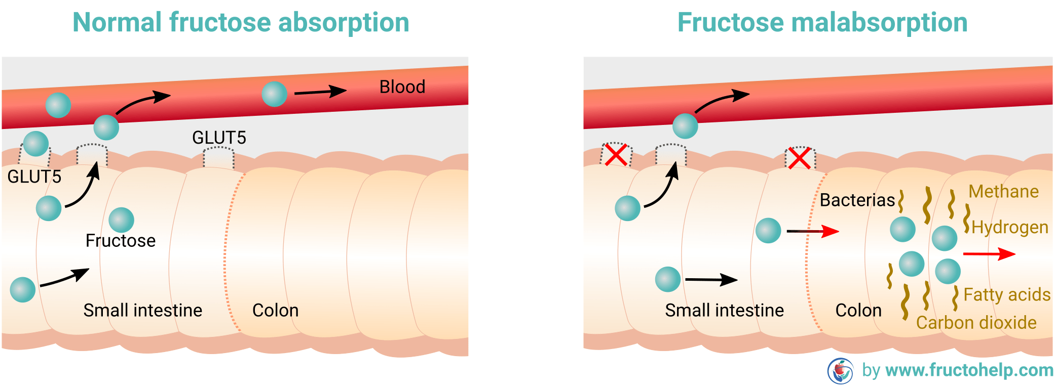 FructoHelp - Normal Fructose Absorption and Fructose Malabsorption (Dietary Fructose Intolerance) - www.fructohelp.com